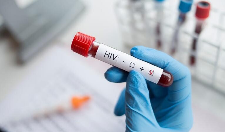 Officials are Exempt from the Scourge of HIV